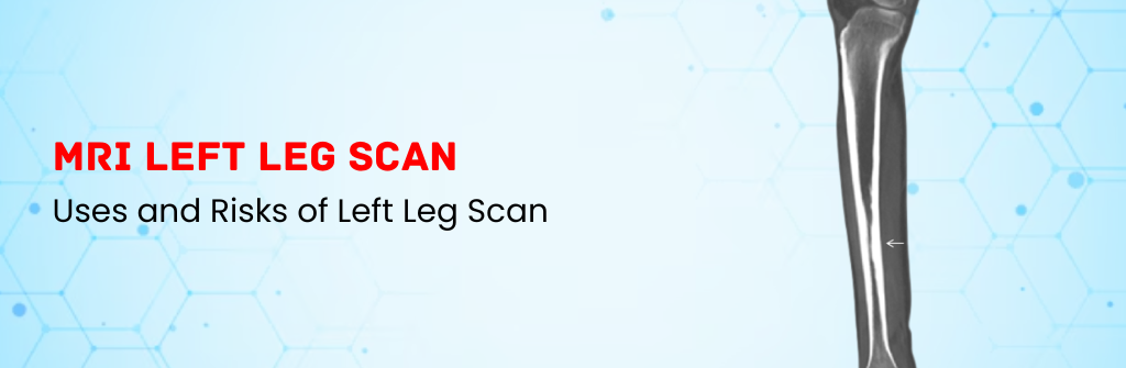  Uses and Risks of MRI Left leg Scan